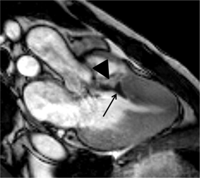 Fig. 20