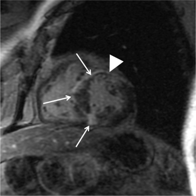 Fig. 18