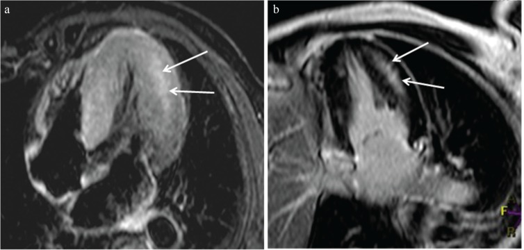 Fig. 10