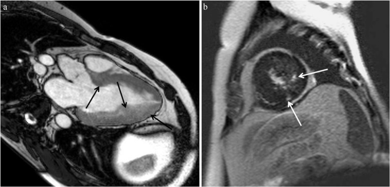 Fig. 13