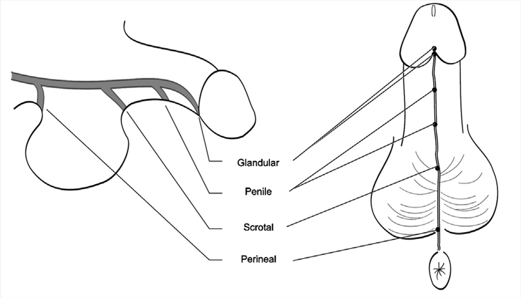 FIG. 14