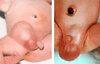 FIG. 13