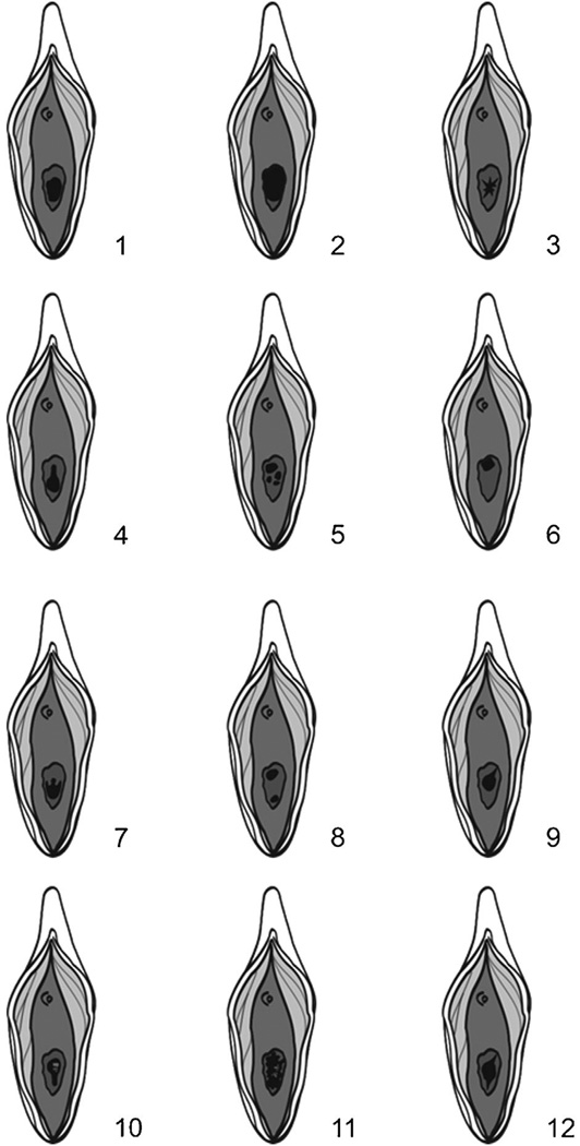 FIG. 35