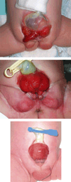 FIG. 5