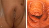 FIG. 44