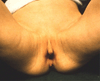 FIG. 42