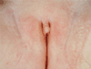 FIG. 46