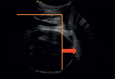 Fig. 12