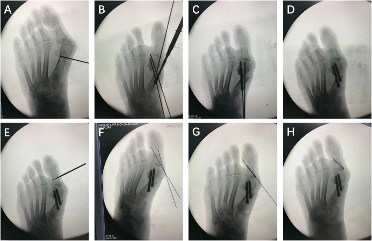 Fig. 2