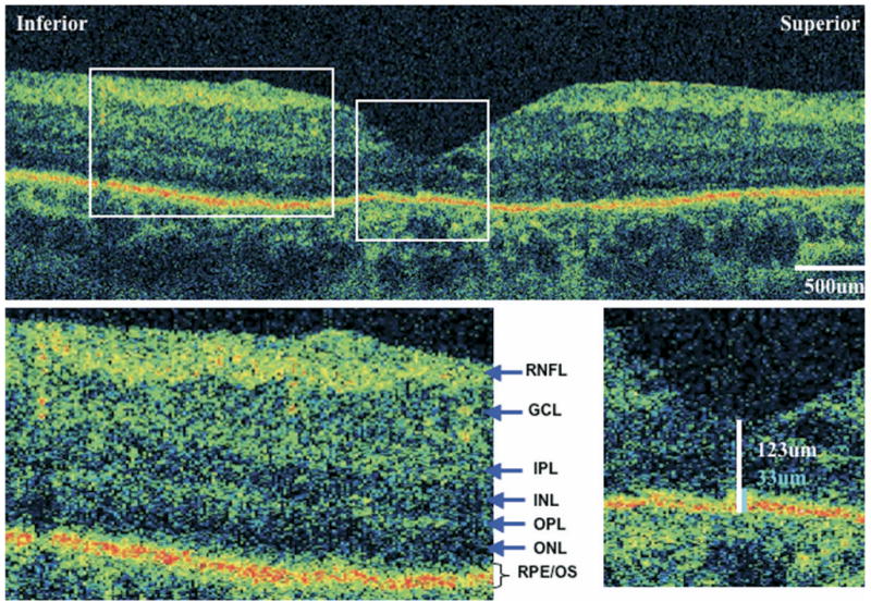 FIGURE 3