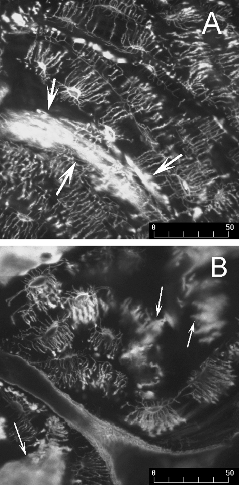 Fig. 12