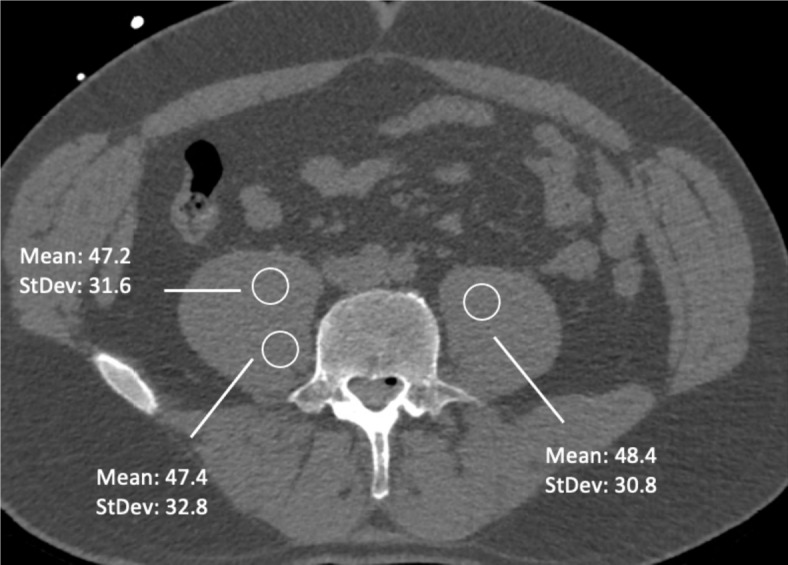 Fig. 3