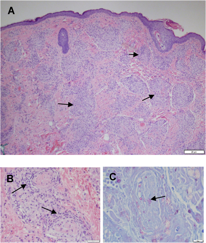 Fig. 2