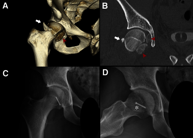 Fig 1