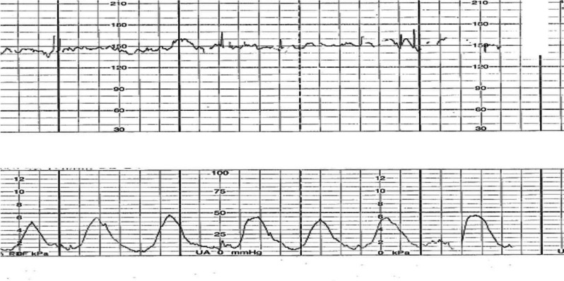 Fig. 2