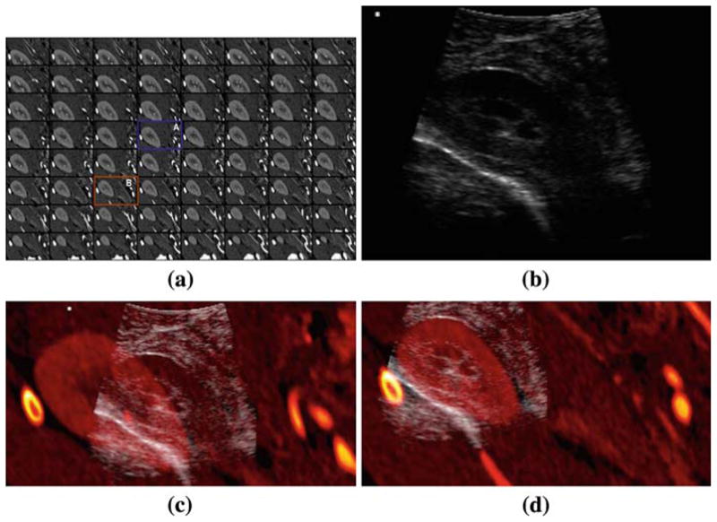 Fig. 12