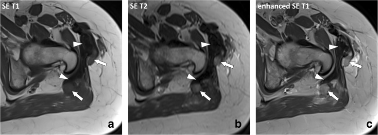 Fig. 15