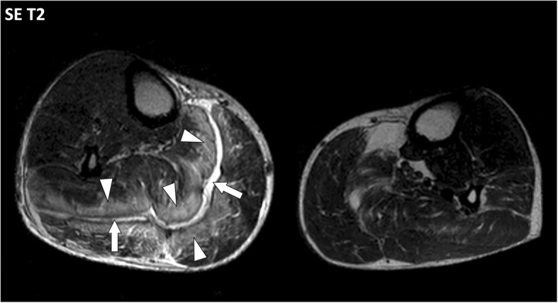 Fig. 11