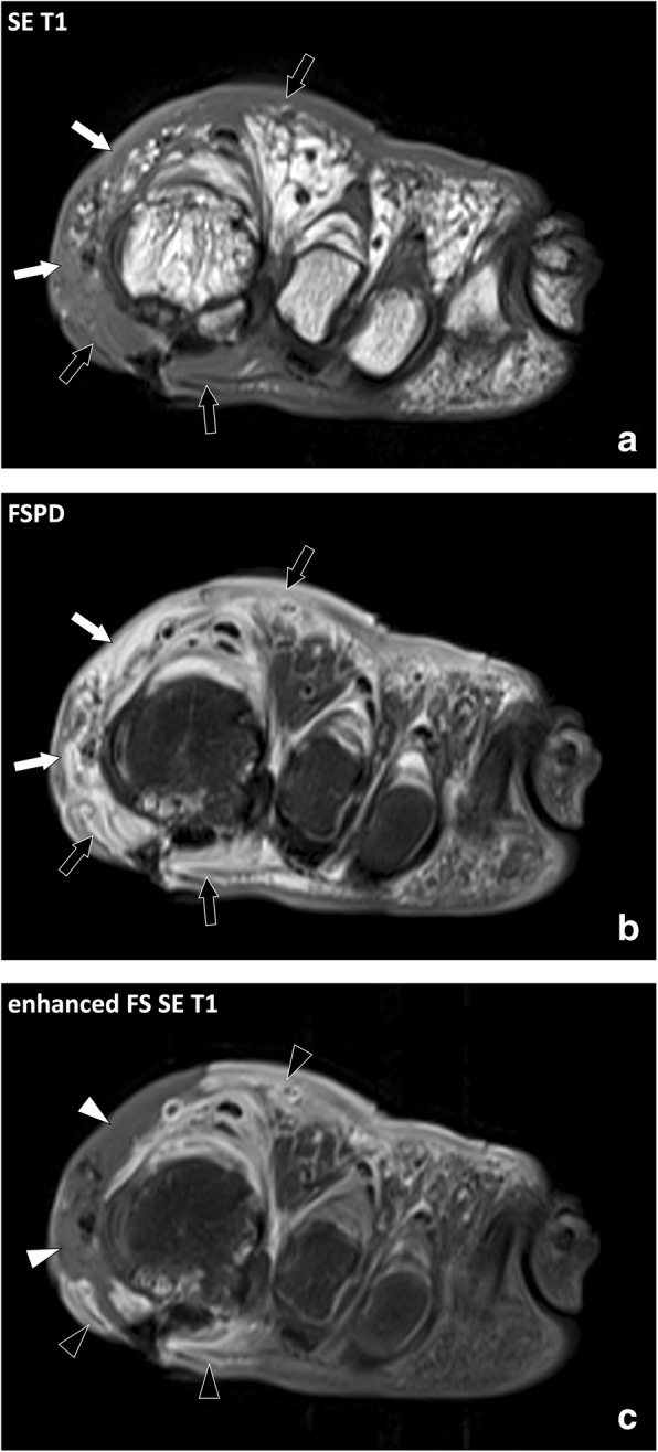 Fig. 9