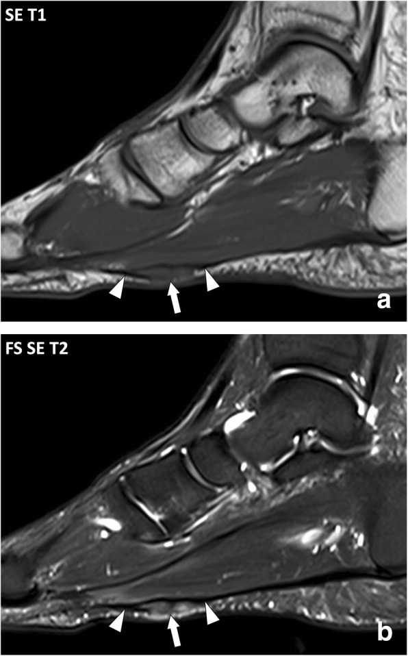 Fig. 13