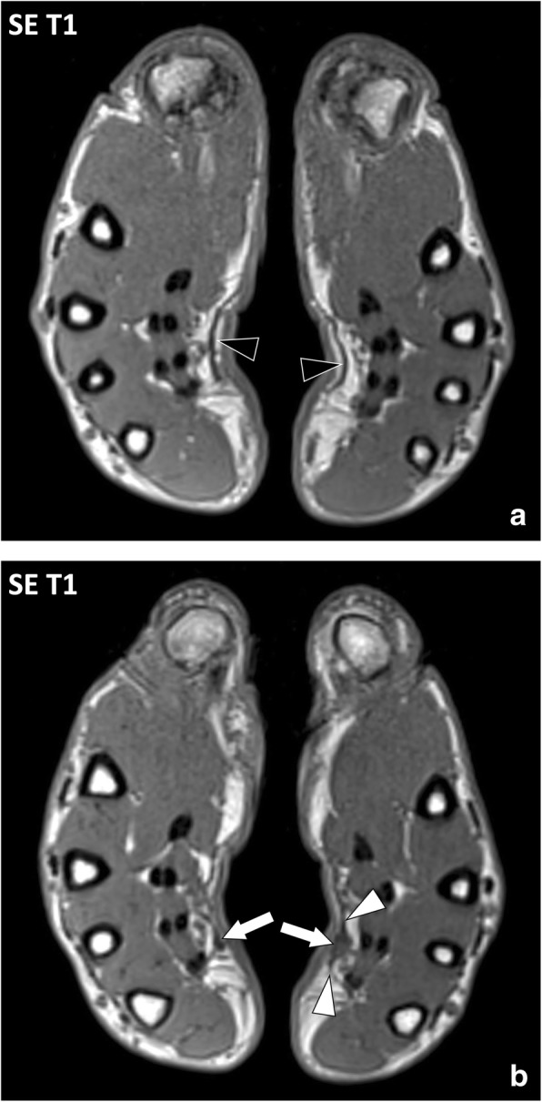 Fig. 12