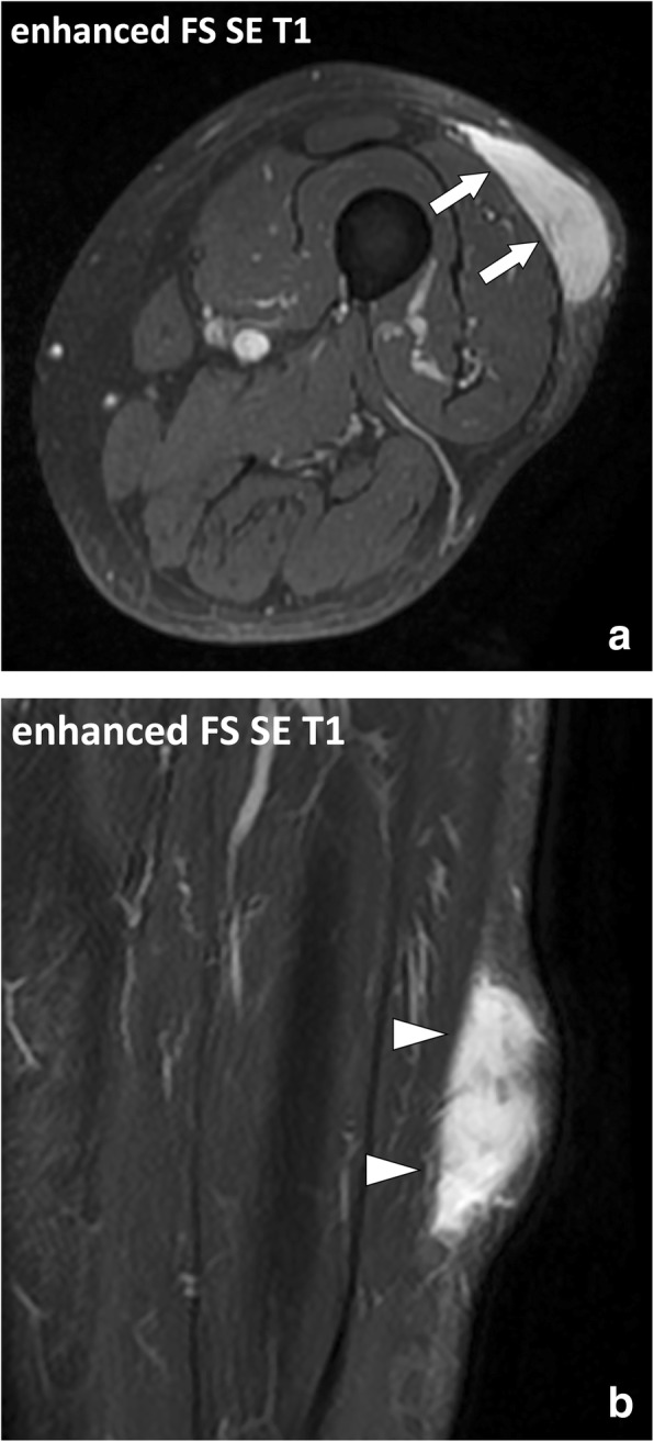 Fig. 16