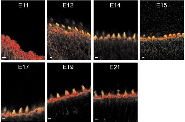 Figure 14.