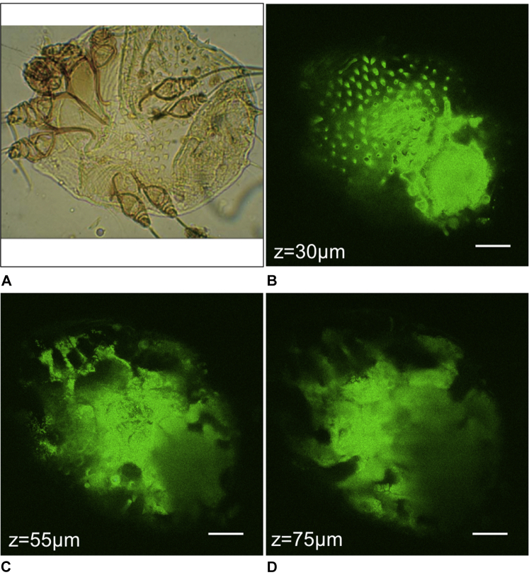 In vivo multiphoton microscopy of scabies - PMC